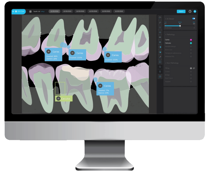 Ai Advanced Dental Technology